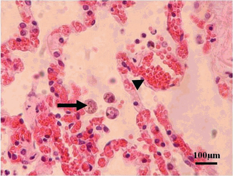 File:Parasite150075-fig1 Toxoplasma gondii in Giant panda.tif