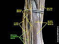brachial cutaneous nerve