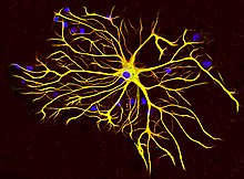 GFAP immunostaining of an astrocyte in cell culture in red and counterstained for vimentin in green. GFAP and vimentin colocalize in cytoplasmic intermediate filaments, so the astrocyte appears yellow. Nuclear DNA is stained blue with DAPI. Antibodies, cell preparation and image generated by EnCor Biotechnology Inc. Astrocyte5.jpg