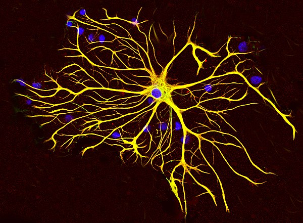 An astrocyte from a rat brain grown in tissue culture and stained with antibodies to GFAP (red) and vimentin (green). Both proteins are present in lar