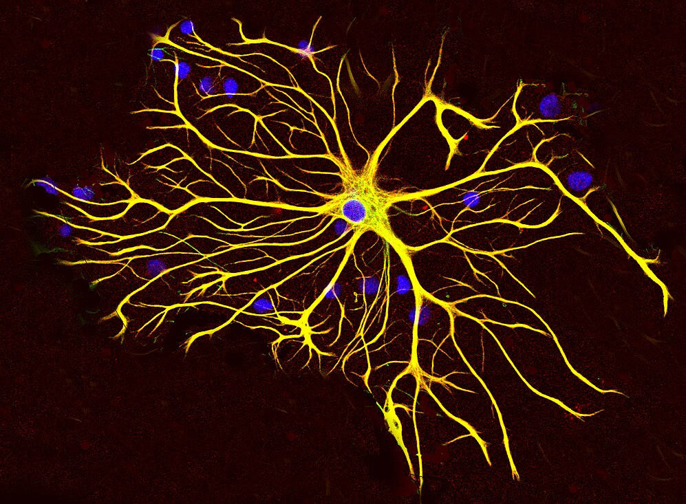 Astrocyte-avatar