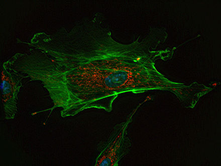 A fluorescent image of an endothelial cell. Nuclei are stained blue, mitochondria are stained red, and microfilaments are stained green.