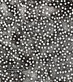 Partícules de l'antigen HBsAg vistes sota un microscopi electrònic.