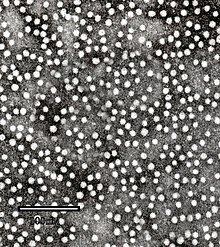 HBsAg under a transmission electron microscope: the protein self assembles into virus-like particles HBsAg.jpg