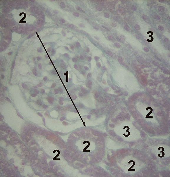 File:Histology-kidney.jpg