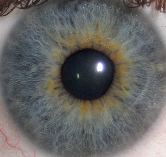 File:Human eye detail, from- Eye Central Heterochromia crop and lighter (cropped).jpg