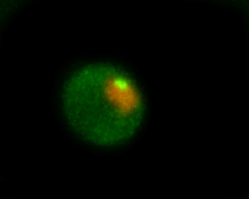 Fichier:JUNQ (green) tethered to the nucleus (orange).tif