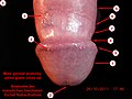 Male genital anatomy - penis glans close-up (Anatomie der männlichen Genitalien - Nahaufnahme der Eichel).jpg