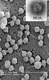 Ortokoronavīrusu bētakoronavīrusu ģints SARS koronavīrusi elektronu mikroskopijā