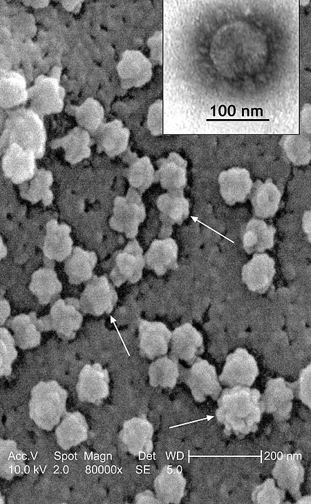 Koronavirus_berkaitan_sindrom_pernafasan_yang_teruk