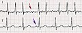 Pisipilt versioonist seisuga 17. detsember 2005, kell 16:18