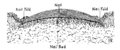 transverse section of nail