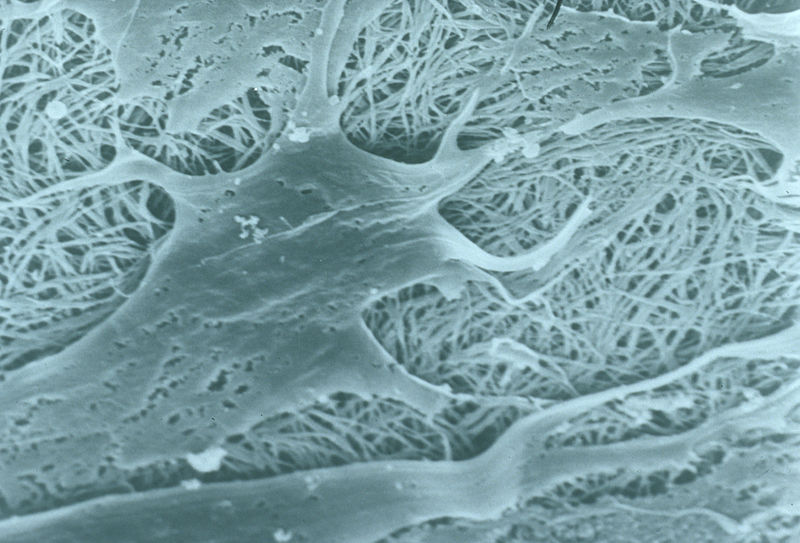 File:CSIRO ScienceImage 293 Cells Interacting With Collagen.jpg