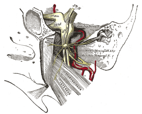 Cavum de Meckel