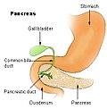 Miniatura para Pancreatite aguda