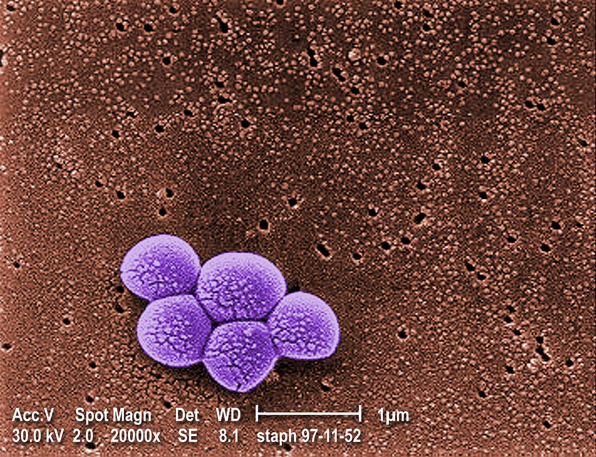 Mrsa Methicillin