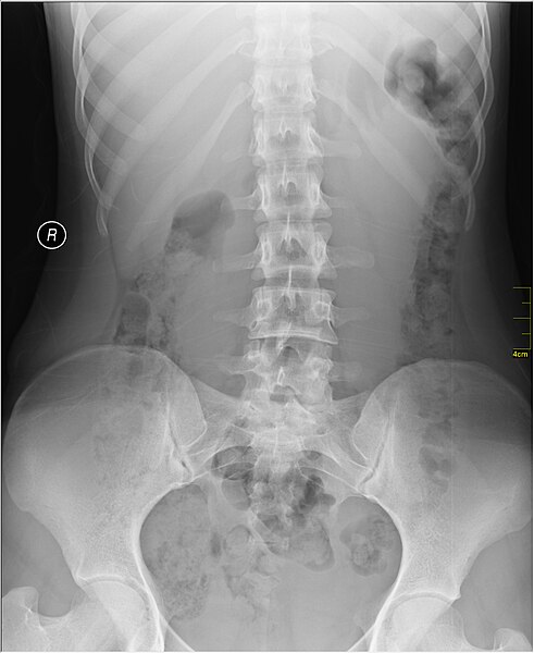 File:Medical X-Ray imaging VGP07 nevit.jpg