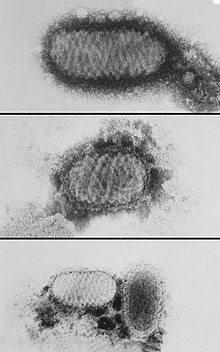 electron micrograph depicting morphologic variants of "Orf virus"