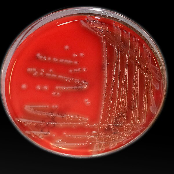 File:Photobacterium damselae 02.jpg