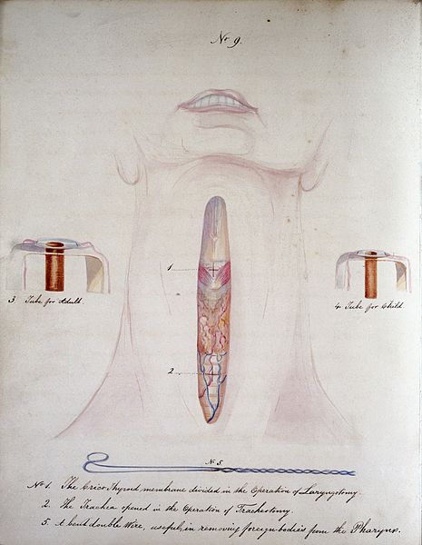 File:An essay on the diseases of the larynx and trachea Wellcome L0029606.jpg