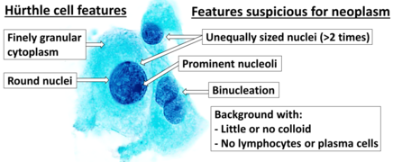 Cytopathology suspicious for Hurthle cell neoplasm, annotated.png