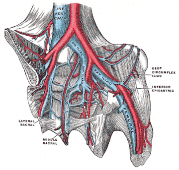 May–Thurner syndrome