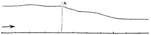 PSM V17 D322 Curve traced by plethysmograph on emotional change.jpg