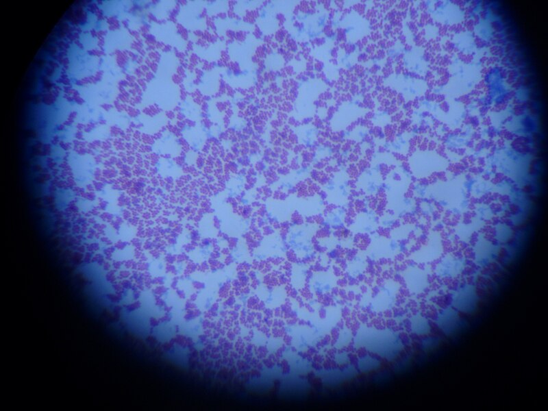 File:Streptococcus group b.JPG