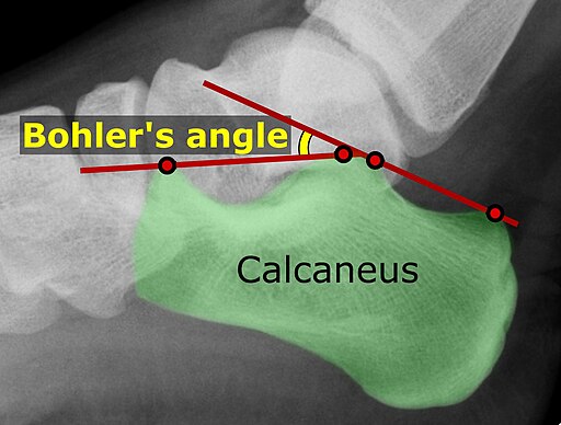 Bohler's angle (raster)