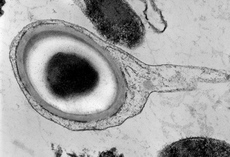 Micrographie électronique de l'endospore de la bactérie Carboxydothermus hydrogénoformans.png