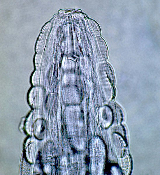 File:Gongylonema pulchrum nematode from man Figure 2b.jpg