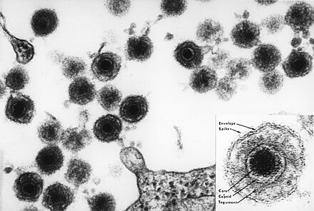 Electron micrograph of one of the HHV6 species