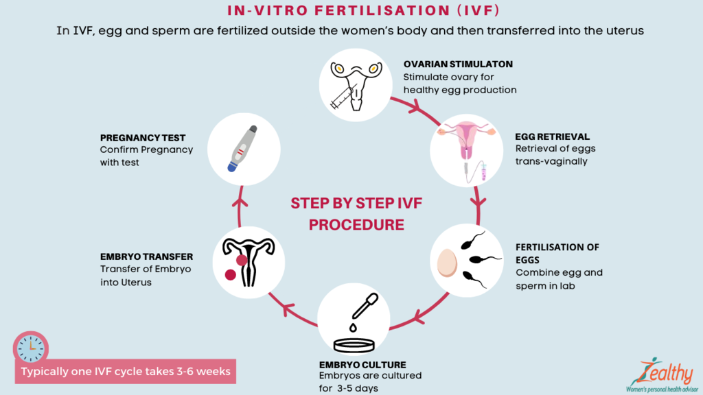In Vitro Fertilization (IVF) - English