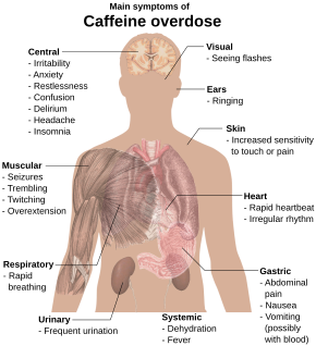 Torso de um jovem com texto sobreposto dos principais efeitos colaterais da overdose de cafeína.