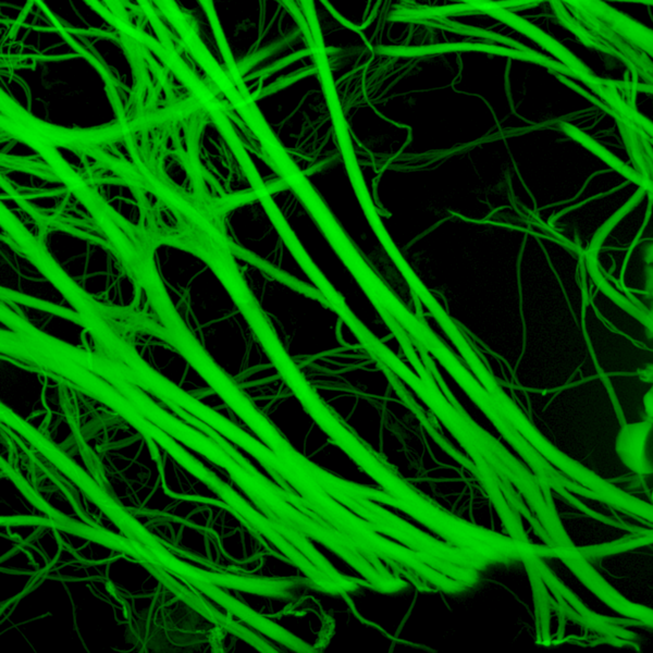 File:STD 190219 SWITCH Tissue 2 93x CMLE 20SNR 50IT Elastin.png