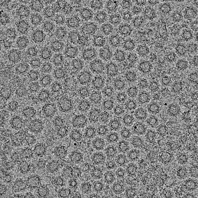Electron micrograph of in vitro-formed COPI-coated vesicles. Average vesicle diameter at the membrane level is 60 nm. COPI coated vesicles.png