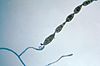 Chain of conidia of a Alternaria sp. fungus PHIL 3962 lores.jpg