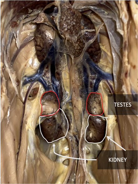 Superior (towards the top) is the chicken's head, inferior (towards the bottom) is the chicken's feet. Chicken's kidneys are visualized at the bottom of the abdomen cavity, along the medial spine of the chicken. Testes are labeled as they sit above the kidneys.