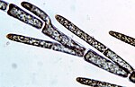 Thumbnail for Cladophoraceae