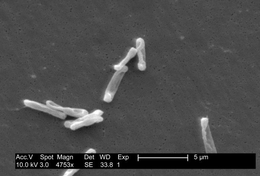 Individual, drumstick-shaped C. difficile bacilli seen through scanning electron microscopy Clostridium difficile EM.png