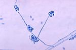 Conidia and conidiophores of the fungus Acremonium falciforme PHIL 4168 lores.jpg