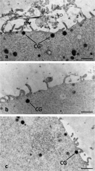 File:Cortical granules.jpg