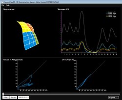 Diseased Patient SLP Scan