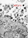 תמונה ממוזערת עבור Human T-Lymphotropic virus 1