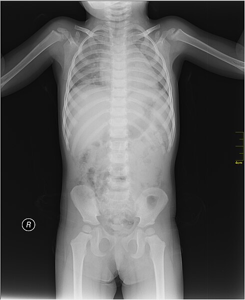 File:Medical X-Ray imaging WVO07 nevit.jpg