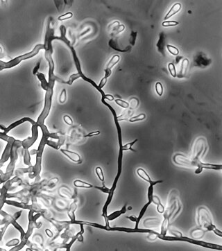 <i>Ochroconis gallopava</i> Species of fungus