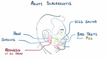 ملف:Sialadenitis.webm