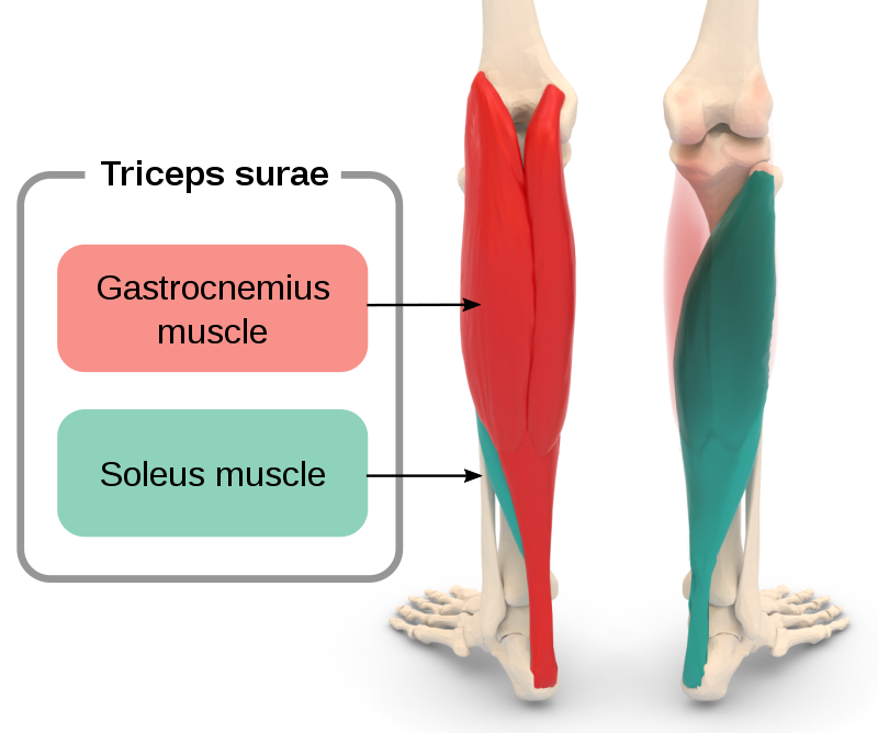 File:Calf muscle strain and tear.svg - Wikimedia Commons