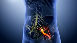 Emerging of low back pain due to the compression of the sciatic nerve. 3D still showing Sciatica nerve.jpg