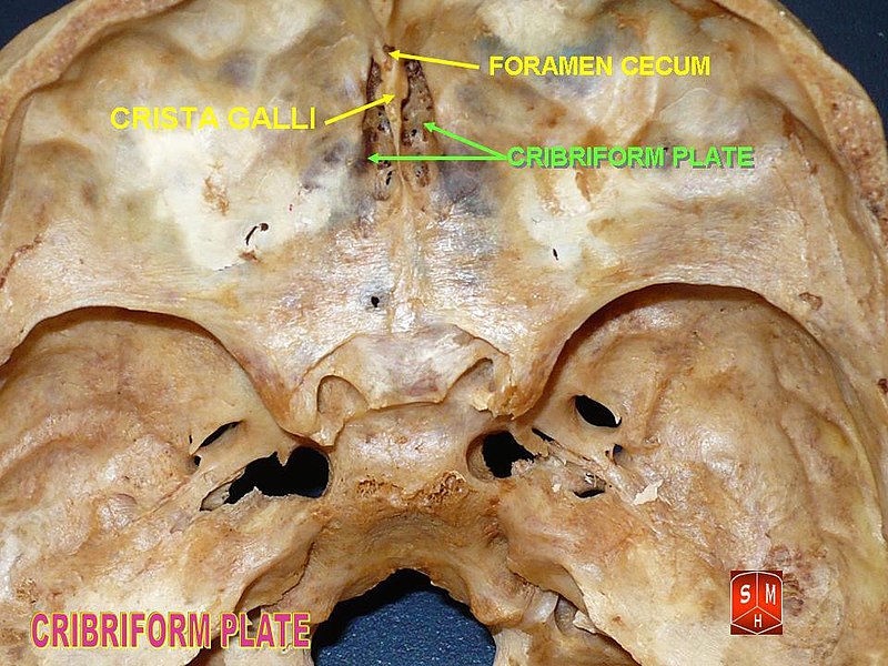 File:Base of skull 3.jpg